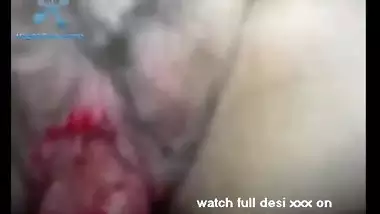 y Hairy Pussy Babe